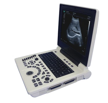 Диагностическая система Беспроводной Зонд Сканер Медицинский Ультразвуковой Мобильный Для беременных Женщин портативный ультразвуковой